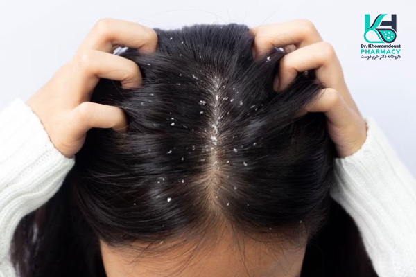 شوره سر چیست؟